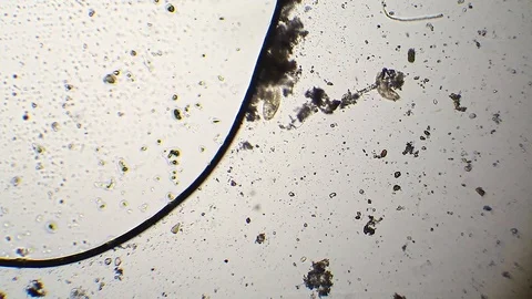 Couple of paramecium at microscope Stock-Footage 87817907