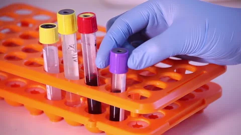 COVID-19 1 Stock Footage 133834643