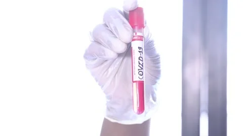 Covid-19 Blood Sample, Closeup Of Doctor Holding Test Tube Stock Footage 130225628