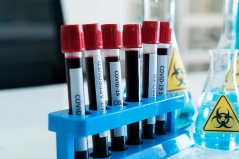 Covid-19 blood test in glass tube at medical laboratory..W Stock Photos