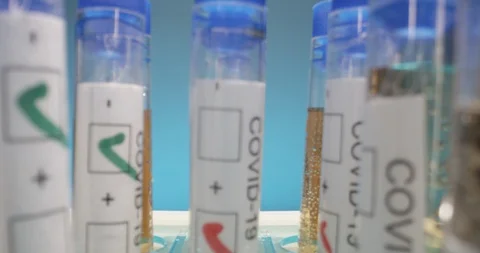 COVID-19 coronavirus laboratory testing ramped slider from vials to wide Stock Footage 127679468