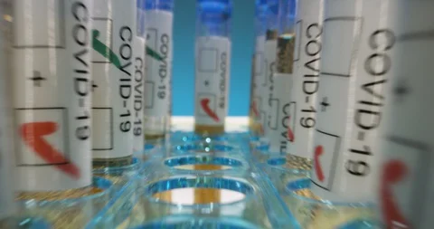 Covid-19 coronavirus laboratory testing negative Video stock 127679826