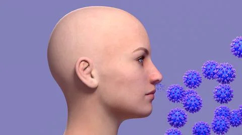 COVID-19 Damage in Olfactory System, SARS-CoV-2 infection in olfactory bulb cell Stock Illustration