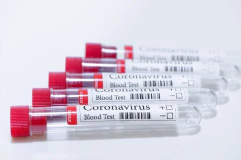 COVID-19 empty laboratory test tubes for blood testing for diagnosis coronavi Stock Photos