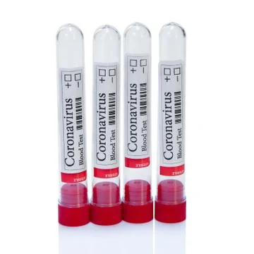 COVID-19 empty laboratory test tubes for blood testing for diagnosis coronavi Stock Photos