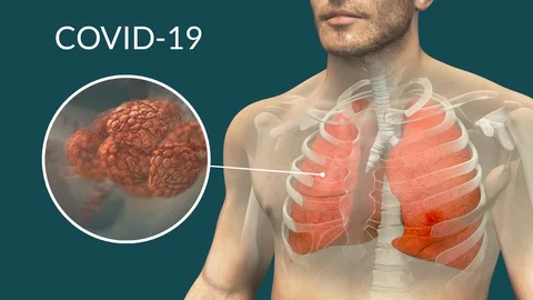 Covid-19 動画素材 127962133