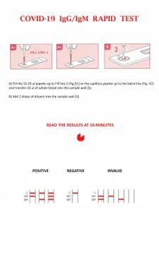 Covid-19 IgG/IgM Rapid Test instruction. SARS-CoV2 Serological Test instruction. Illustrazione stock