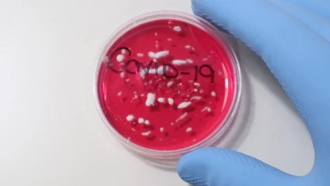 COVID-19 Lab Culture Testing for Cure Stock-Footage 129581253