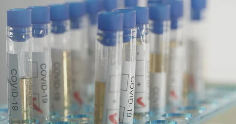 Covid-19 laboratory testing fluid in test tubes Stock Footage 127651677