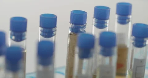 COVID-19 Lung fluid samples from patients in hospital Stock Footage 127651744