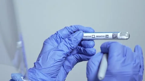 Covid-19 negative test Covid19 epidemic Stock Footage 167621768