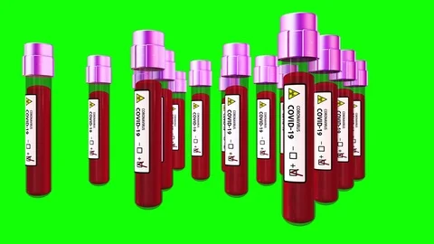 COVID 19 outbreak animation Test Coronavirus 4K .2019 ncov background. Stock Footage 126000864