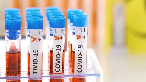 The Covid-19 positive test sample for coronavirus biological hazard sign Stock Footage 127765518