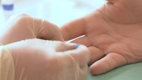 COVID-19 rapid test. Positive COVID-19. Blood sampling from a finger. Stock Footage 130615982