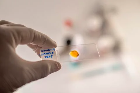 Covid -19 sample Stock Photos