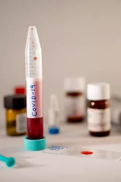 Covid 19 sample Stock Photos