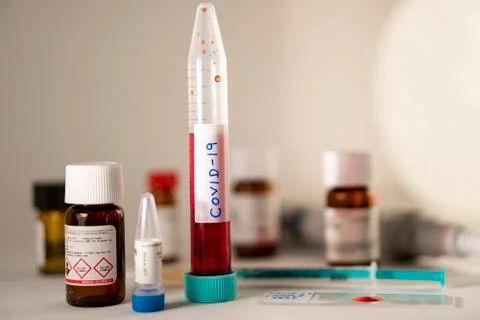 Covid 19 sample Stock Photos