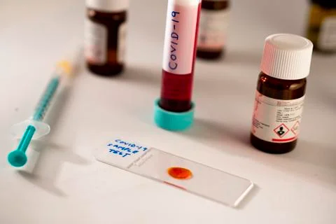 Covid -19 sample Stock Photos