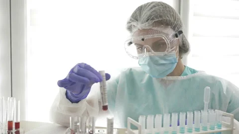 COVID-19 test. Laboratory sample of blood testing for diagnosis coronavirus Stock Footage 129385653