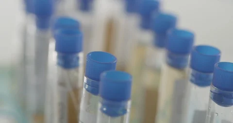 COVID-19 Test tubes in lab Stock Footage 127651819