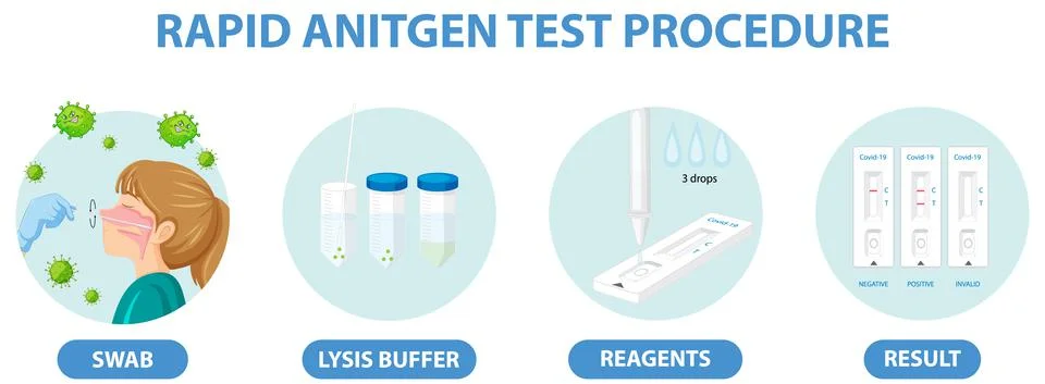 Covid 19 testing with antigen test kit Ilustración de archivo
