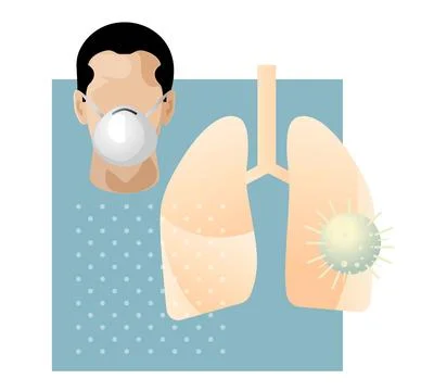 Covid-19 Testing - CT Scan - Human Lungs HRCT - Illustration Stock Illustration