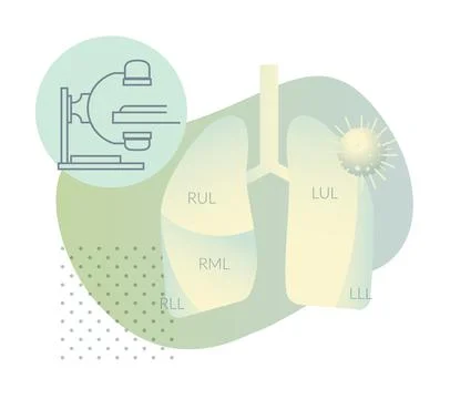 Covid-19 Testing - CT Scan - Human Lungs HRCT - Illustration Illustrazione stock