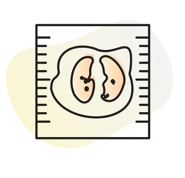 Covid-19 Testing - Human Lungs CT Scan - Illustration Stock Illustration