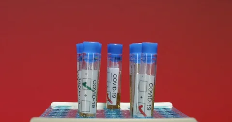 Covid 19 testing in laboratory red background Stock Footage 127679626