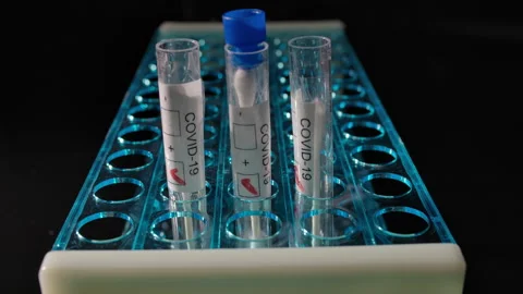 Covid 19 three test tubes with nasal swabs Stock Footage 142403402
