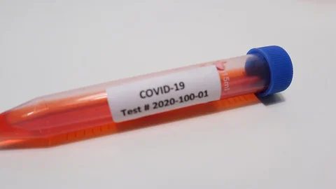 COVID-19 Vial moving from out of focus into focus with blue glove 動画素材 129581353