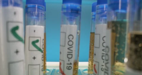 Covid-19 vials close up macro slider in laboratory Stock Footage 127679288