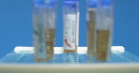 COVID-19 vials for testing on blue background Stock Footage 127678131