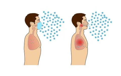 COVID-19 Visual Support, infographics, Coronavirus protection concept. medica Stock Illustration