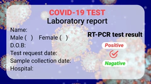 Covid laboratory test report animation Stock Footage 229537474
