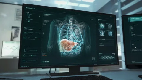 Covid Research Is Held In Medical Program Displayed On Computer Screen 스톡 동영상 155715114