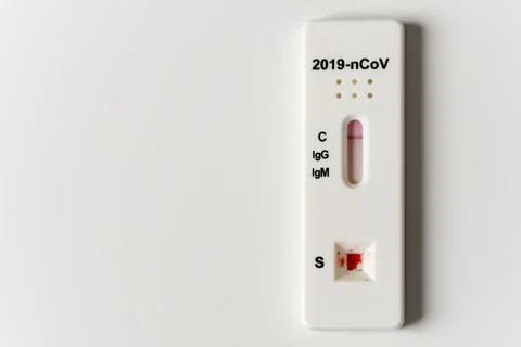 COVID test and laboratory sample of blood testing for diagnosis new Corona virus Stock Photos
