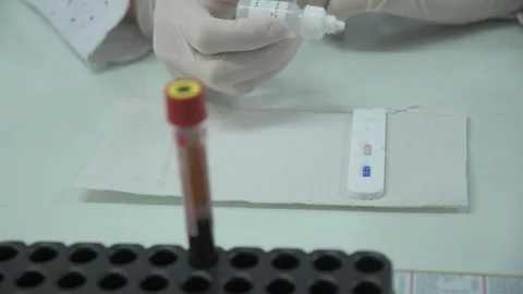 Covid test Video stock 136199237
