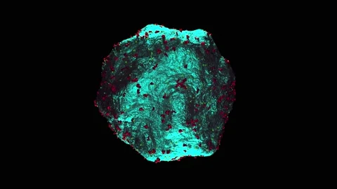 Covid Virus Xray with Artifical Intelligence 4k Stock Footage