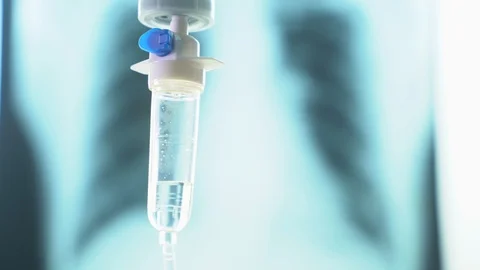 CovidSaline drip medical,IV Drip Solution Vídeos de archivo 126749760