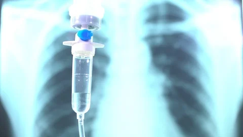CovidSaline drip medical,IV Drip Solution Vídeos de archivo 126749791