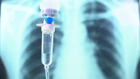 CovidSaline drip medical,IV Drip Solution Video stock 126749798