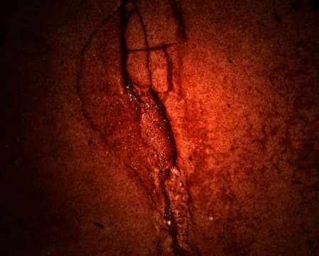 Cracked Back Видео 102352