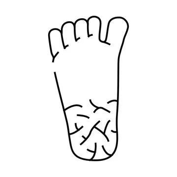 Cracked heels line icon vector illustration Stockillustratie