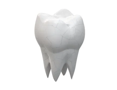 Cracked molar tooth Stock Illustration