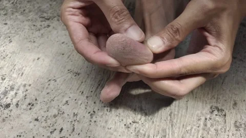 Cracked Toe Skin Stock Footage 318576548