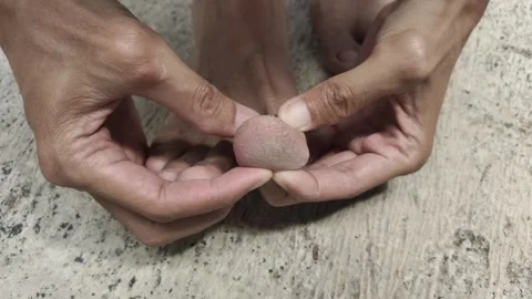 Cracked Toe Skin Stock Footage 318576558
