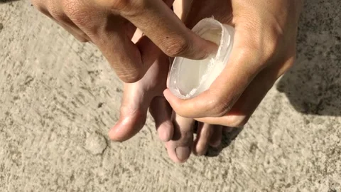 Cracked Toe Skin Stock Footage 323986279