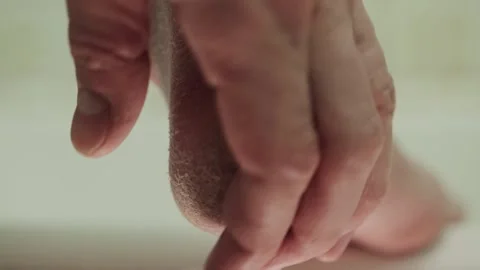 Cracking and peeling of the skin on the heels of a persons feet, close-up. Skin Video stock 243161809