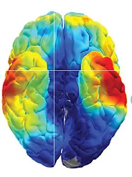  Cracking brain memory codes NIH scientists have used electrical recording... Stock Photos